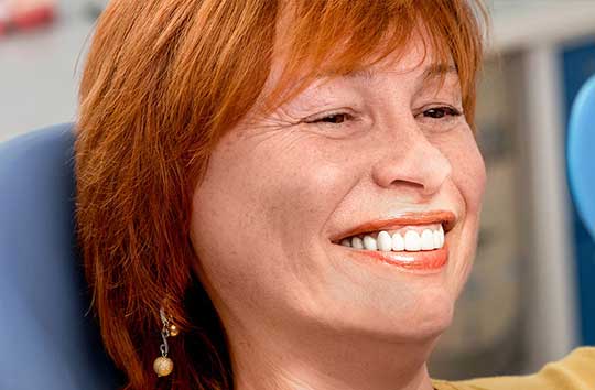Porcelain Veneers