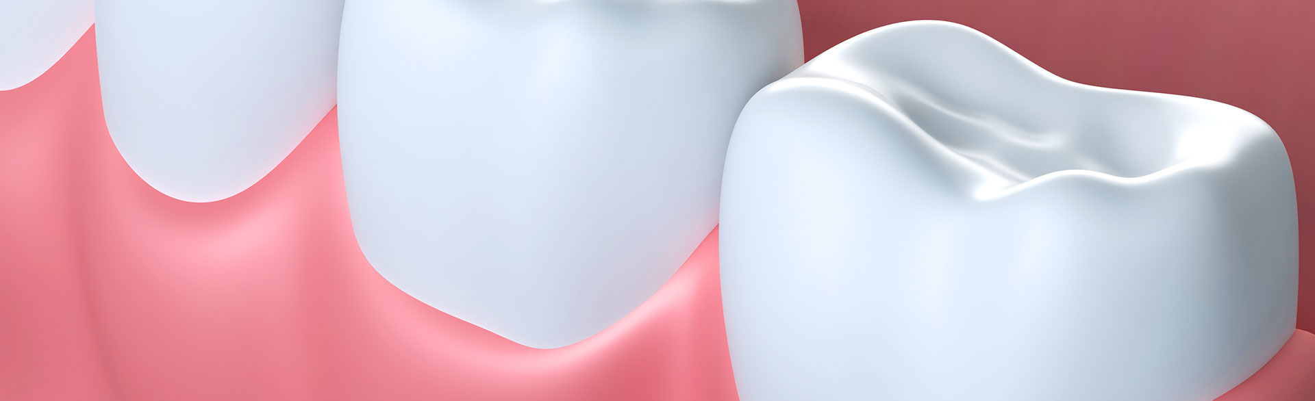illustration of teeth and their gum line
