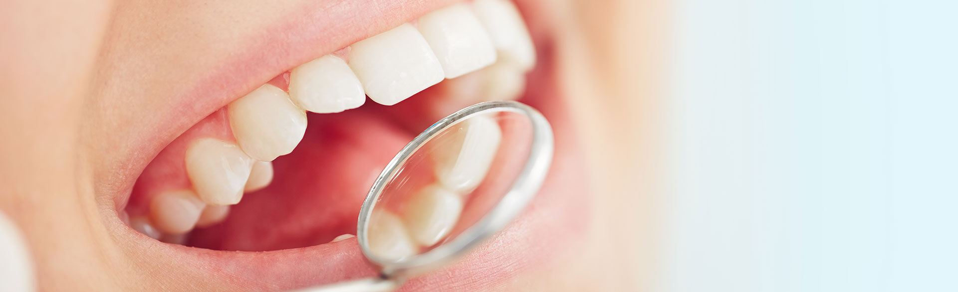 closeup of a person receiving a dental exam