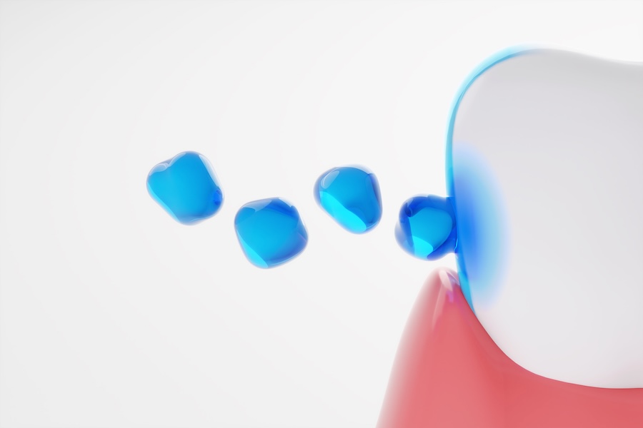 fluoride helps prevent cavities on a tooth
