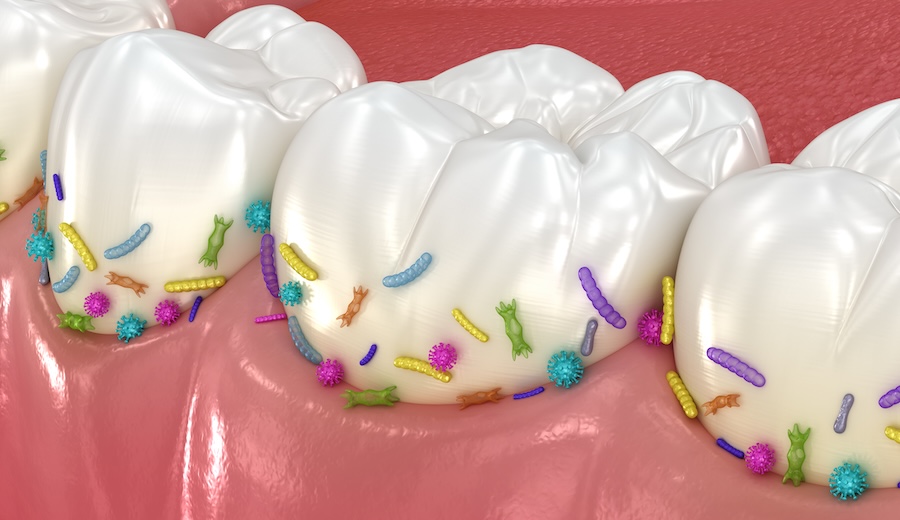 reduce mouth bacteria, gum disease, decay